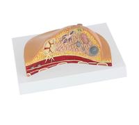 1: 1 Modelo de sección mediana la patología mama humana Kit modelo anatomía tabla lesión seno lactantes senos