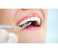 1 implante dental con limpieza bucal radiografia estudio implantologico