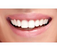 1 implante dental de titanio con corona de metal y porcelana más limpieza bucal