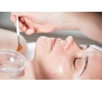 1 limpieza facial profunda con extracción peeling químico e hidratación