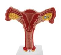 1 Pieza 1:1 Modelo de útero Femenino Humano, Ovario, trompas de Falopio, Modelo anatómico de anatomía Humana, Herramientas de enseñanza médica