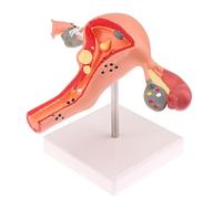 1 pieza de accesorios médicos, modelo patológico de útero y ovario, modelo anatómico, herramienta de estudio de sección transversal de anatomía