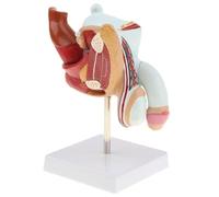 1 pieza de modelo anatómico de anatomía de los órganos reproductivos del pene humano enfermo for reproducción masculina médica, modelos de patología del sistema urinario