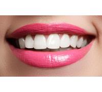 1 sesión de limpieza bucal con ultrasonidos revisión y radiografía periapical