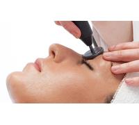 1 sesión de radiofrecuencia facial Indiba