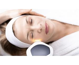 1 sesión de tratamiento láser Hollywood Peel con mascarilla hidratante intensiva