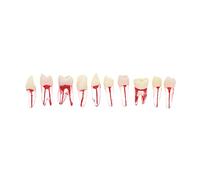 10 unidades de cavidad de pulpa de conducto radicular dental RCT práctica dientes endodónticos modelo Typodont estudio enseñar M8007-Kit