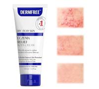 100g Ungüento para Eccema, loción corporal para pieles propensas a eczemas, ungüento calmante e hidratante, Crema corporal hidratante