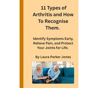 11 Types of Arthritis and How To Recognize Them.: Identify Symptoms Early, Relieve Pain, and Protect Your Joints for Life. (How to live with arthritis)