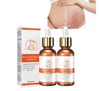 2/3/4PCS Stretch Mark Repair Essential Oil,Stretch Mark Oil for Pregnancy,Pregnancy Oil to Prevent Stretch Marks,Remove Stretch Marks,For Repair Scar Postpartum Essential Oil (2PCS)