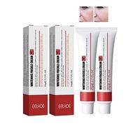 2 Pcs Whitening Freckle Cream, Spot-off Freckle Whitening Cream, Remove Melasma Cream, Acne Scar Removal Cream, Remove Melasma Melanin Dark Spots, Skin Whitening Cream (2 Anti-Blemish Cream)
