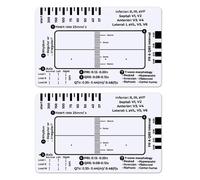 2 reglas de ECG de 7 pasos para interpretación de ECG/EKG
