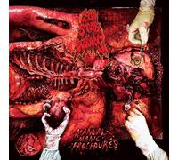 200 Stab Wounds - Manual Manic Procedures