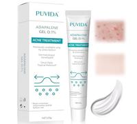 20g Acne Crema Facial, Facial Acne Crema, Reduce Granos, Puntos Negros y Rojeces, Para Todo Tipo de Pieles