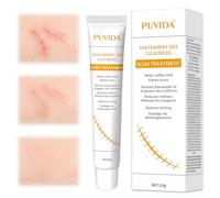 20g Crema para cicatrices, Crema Reparación Cutánea, Mejorar Apariencia de los defectos la piel, Cuidado Diario De La Piel, Fácil de aplicar, Para Hombres y Mujeres