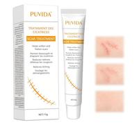 20g Crema para cicatrices, Gel para cicatrices, Crema para el apoyo a la reparación cutánea, Ayuda a mejorar el aspecto de marcas en la piel, Adecuado para uso diario