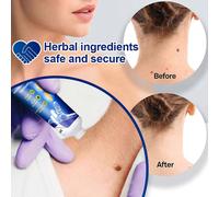 20g Crème anti-verrues à base d'extraits de plantes pommade antibactérienne pour le traitement des taches sur la peau