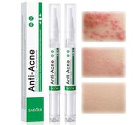 2mlx2 Anti Acné Pen,Acne Facial Skincare Pen,Portable Facial Skincare Pens,Cuidado de la piel grasa y con tendencia al acné Pen,Cuidado facial diario