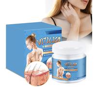 2pcs Crema De Cuidado De Vitiligo Para La Piel Vitiligo,Crema De Vitiligo,Cremas Para El Cuidado Del Vitiligo,Elimina Las Manchas Blancas,Mejora La Pigmentación Reguladora De La Crema De Vitiligo