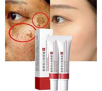 2Pcs Whitening Freckle Cream,Acne Scar Removal Treatment Cream,Pigmentation Removal Cream for Face,Effectively Removes Facial Melasma,Dark Spots,Blemishes