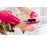 3 sesiones de dermapen con tratamiento hidratante vitaminas y terapia de luz led