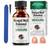 30ml Gotas Para Cuidado De Uñas De los Pies, Cuidado Uñass Dañadas, Calmar y Nutrir Las Uñas,Cuidados Diaria y Mejora Aspecto Pie, Fortalece la Estructura de la Uña