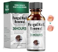 30ml Gotas para Cuidado De Uñas De los Pies,Reparadores de Uñas Solución,Calmar y Nutrir Las uñas,cuidado Diaria y Mejora Aspecto,Para Dañadas Y Descoloridas