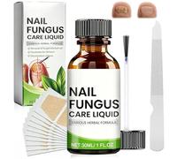 30ml Reparadores De Uñas Solución, 20 Piezas Patches de Reparación De uñas,Pueden Calmar y Nutrir Las Uñas, para Uña Gruesas, Rotas, Descoloridas y Dañadas, Mejora Apariencia de Uña Decoloradas