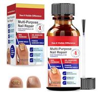30ml Reparadores De Uñas Solución, Tratamiento De Uñas Los Pies, Pueden Calmar Y Nutrir Las Fortalece La Uña, Cuidado Diaria Y Mejora Aspecto, Para Decoloradas Los Pies