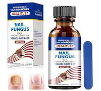 30ml Solución Uñas,Cuidado de la cutícula Aceites para uñas encarnadas,Reparadores de Uñass Solución,Fortalece la Uña,Restaura el Aspecto las Uñass,Nutre, Hidrata