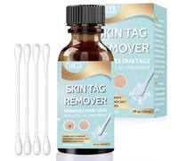 30ML Verrugas Remover, Quitar Marcas de Piel, Fácil De Usar, Solución Eficaz para la Eliminación los Callos para la mayoría de los tipos de piel, Azul Claro
