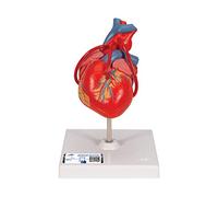 3B Scientific G05 Modelo Anatómico Humano - Corazón Clásico con Bypass, De 2 Piezas + App de anatomía gratuita - 3B Smart Anatomy