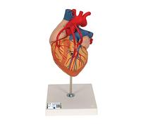 3B Scientific G06 Corazón Con Bypass, 2 Veces el Tamaño Natural, de 4 Piezas - 3B Smart Anatomy