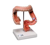 3B Scientific K55 Modelo de anatomía humana racto intestinal