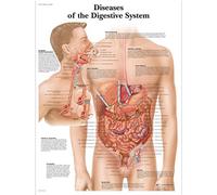 3B Scientific - Lámina Plastificada de las Enfermedades del Sistema Digestivo - Póster de Patología Protegido contra UV y Polvo para Estudio, Enseñanza y Clínicas