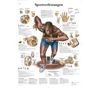 3B Scientific - Laminado Lesiones Deportivas Cartel - Póster de Anatomía Protegido contra UV y Polvo para Estudio, Enseñanza y Clínicas