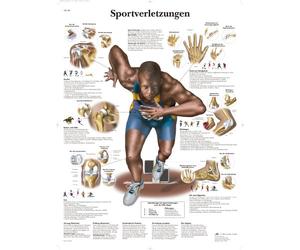 3B Scientific - Laminado Lesiones Deportivas Cartel - Póster de Anatomía Protegido contra UV y Polvo para Estudio, Enseñanza y Clínicas