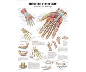 3B Scientific - Laminado Mano & Muñeca Cartel - Anatomía & Patología - Póster Protegido contra UV y Polvo para Estudio, Enseñanza y Clínicas