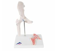 3B Scientific® Mini Articulación de Cadera - Modelo de Cadera Humana a Media Escala con Sección Transversal para Enseñanza de Anatomía + Smart Anatomy App (Garantía de 5 Años)
