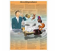 3B Scientific - Modelo anatómico de alcohol