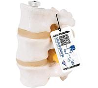 3B Scientific® Modelo de 3 Vértebras Lumbares - Segmento Vertebral a Tamaño Real con Discos Intervertebrales, Montaje Flexible + Smart Anatomy App (Garantía de 5 Años)