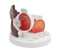 3B Scientific Ojo patológico, 5 veces su tamaño natural, tono de piel oscuro, 3B Smart Anatomy