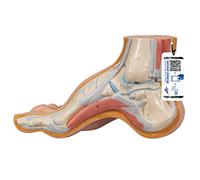 3B Scientific® Pie Cavo (Pes Cavus) - Modelo Anatómico Humano a Tamaño Real + Smart Anatomy App (Garantía de 5 Años)