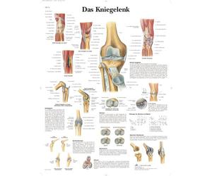 3B Scientific Póster de Anatomía de la Rodilla, Tabla Didáctica de Ligamentos, Meniscos y Patologías para Educación Médica y Anatómica, Póster Educativo de la Articulación de la Rodilla