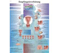 3B Scientific Póster de Anatomía de los Métodos Anticonceptivos, Tabla Didáctica sobre la Salud Reproductiva Femenina, Póster Educativo sobre Anticoncepción