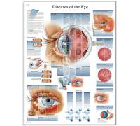 3B Scientific Póster de Anatomía Oftalmológica y Trastornos Oculares, Póster de Pared sobre Trastornos de la Visión para Estudiantes de Medicina, Enfermería y Formación Sanitaria