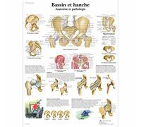 3B Scientific Póster de Anatomía Pélvica, Tabla Didáctica de la Articulación de la Cadera, Ligamentos y Patologías para Educación Médica, Póster Educativo de la Cadera y la Pelvis