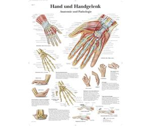 3B Scientific Póster Educativo de Anatomía y Patologías de la Mano y la Muñeca, Póster Ortopédico de Pared para Estudiantes de Medicina, Fisioterapia, Enfermería y Formación Sanitaria