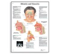 3B Scientific rinitis o Sinusitis guía de posición de