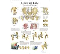 3B Scientific VR0172UU - Pizarra - Pelvis y Cadera - Anatomía y Patología